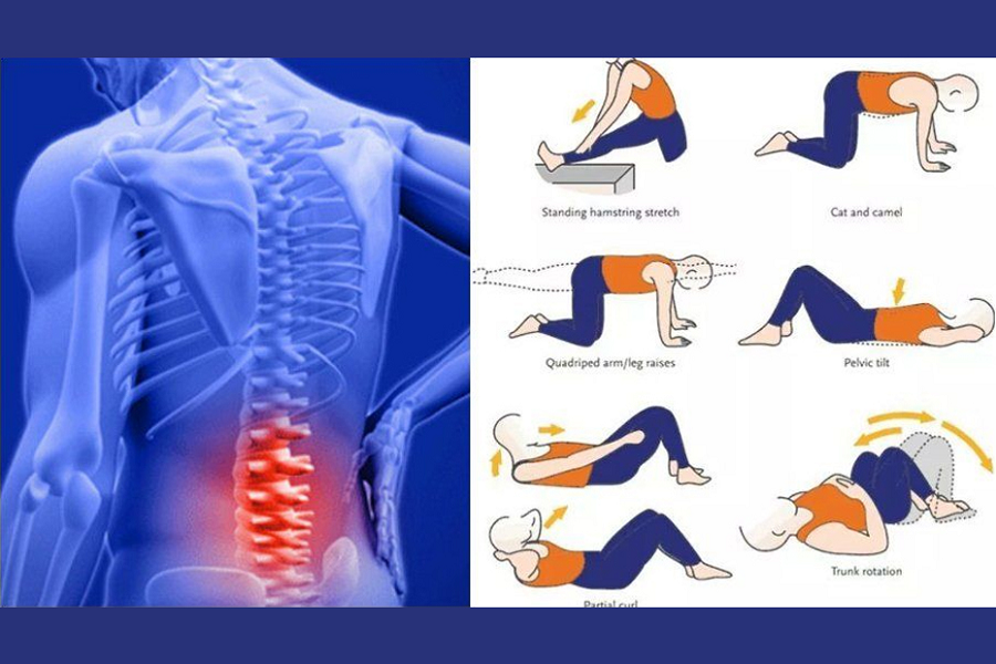The Purpose of Lower Back Pain Exercises