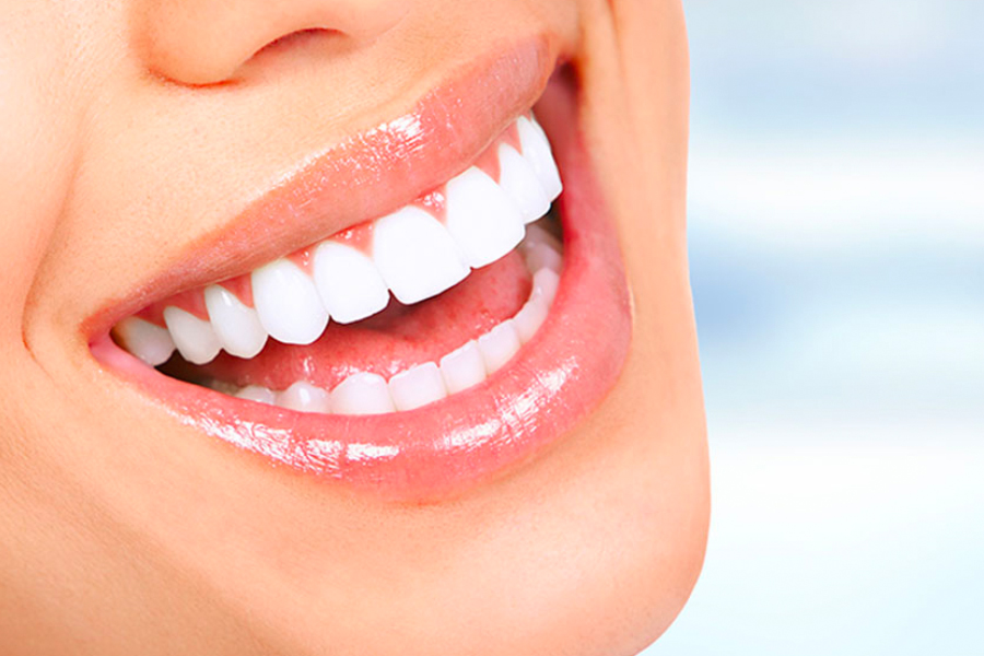 Factors To Consider When Choosing A Teeth Whitening Dentist In Adelaide