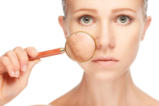 Laser Treatment for Pigmentation: How It Works and What to Expec